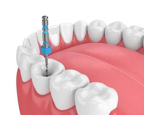 عيادة الدكتور محمد النوافلة لطب الأسنان والتجميل